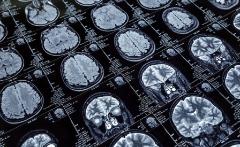 Esplorare il cervello con la risonanza magnetica - Come svelarne struttura e funzioni