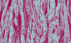 Il bandolo della biomassa - Una risorsa versatile e sostenibile